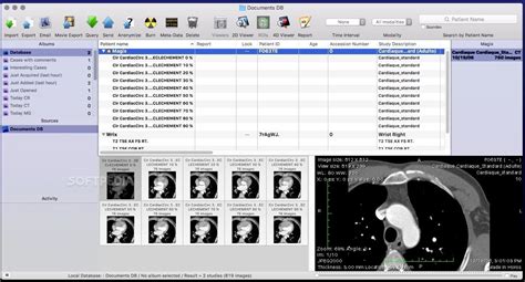 stl viewer mac|dicom image viewer for mac.